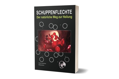 Schuppenflechte - Der natürliche Weg zur Heilung 3,99 €