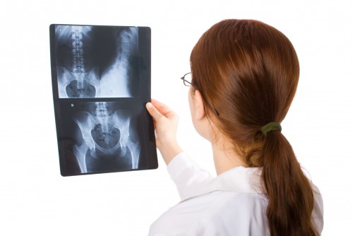 Warum führen Röntgenbilder zu Fehldiagnosen?